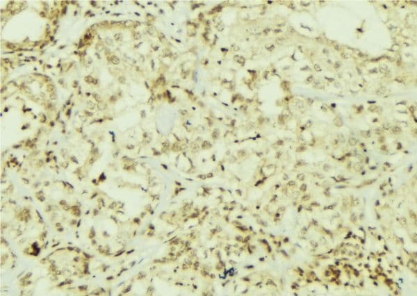 Polyclonal Rabbit anti-Human AKT1 Antibody (phospho-Tyr316,phospho-Tyr315,phospho-Tyr312, IHC, IF, WB)