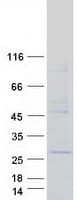 Human INSIG2 Protein (Recombinant Myc-DDK (Flag))