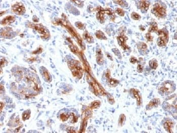 CFTR Antibody (clone CFTR/1341)