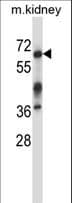 IRAK3 / IRAKM / IRAK-M Antibody (aa517-544)
