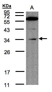 Polyclonal Rabbit anti-Human KIAA0152 / MLEC Antibody (aa106-292, IHC, WB)