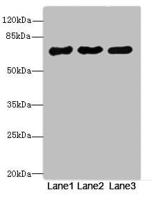 PPM1D / WIP1 Antibody