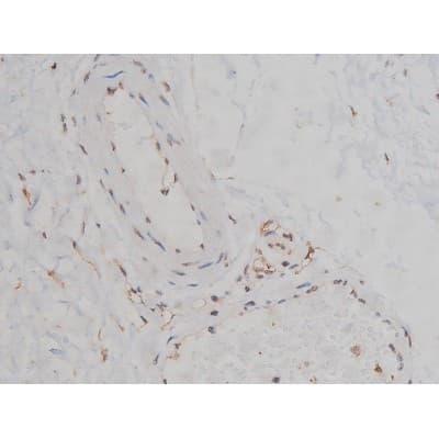 SYN / FYN Antibody (phospho-Tyr530)