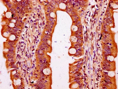 SLC6A19 Antibody