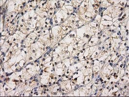 Monoclonal Mouse anti-Human EIF4E2 / IF4e Antibody (clone OTI1C1, IHC, WB)