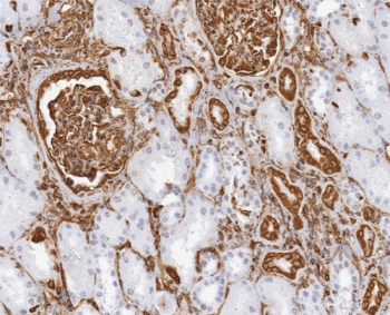 Vimentin Antibody (aa435-465)