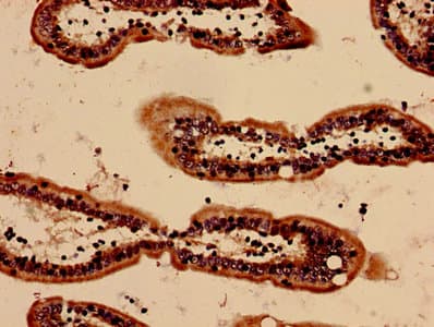 SAA1 / SAA / Serum Amyloid A Antibody
