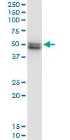 VRK1 Antibody (clone 4F9)