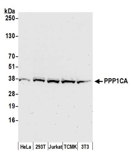 IHC-plus™ Polyclonal Rabbit anti-Human PPP1CA / PP1-Alpha Antibody (aa280-C-term, IHC, WB)