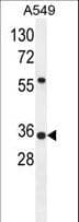 SOWAHD / ANKRD58 Antibody (aa196-224)