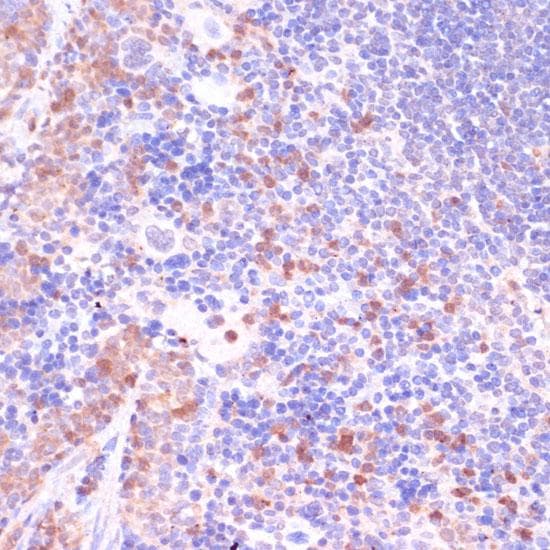 Polyclonal Rabbit anti-Human UGT2B15 Antibody (IHC)