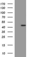 MMP13 Antibody (aa104-471, clone OTI2D8)