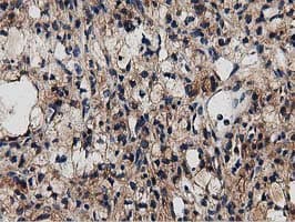 Monoclonal Mouse anti-Human MYD88 Antibody (clone OTI2B2, IHC, IF, WB)