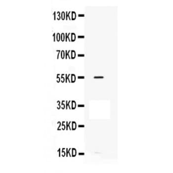 MMP12 Antibody (aa432-466)