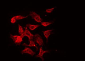 GHRHR Antibody