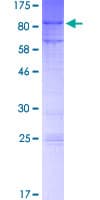 Human MTF2 / PCL2 Protein (Recombinant GST)