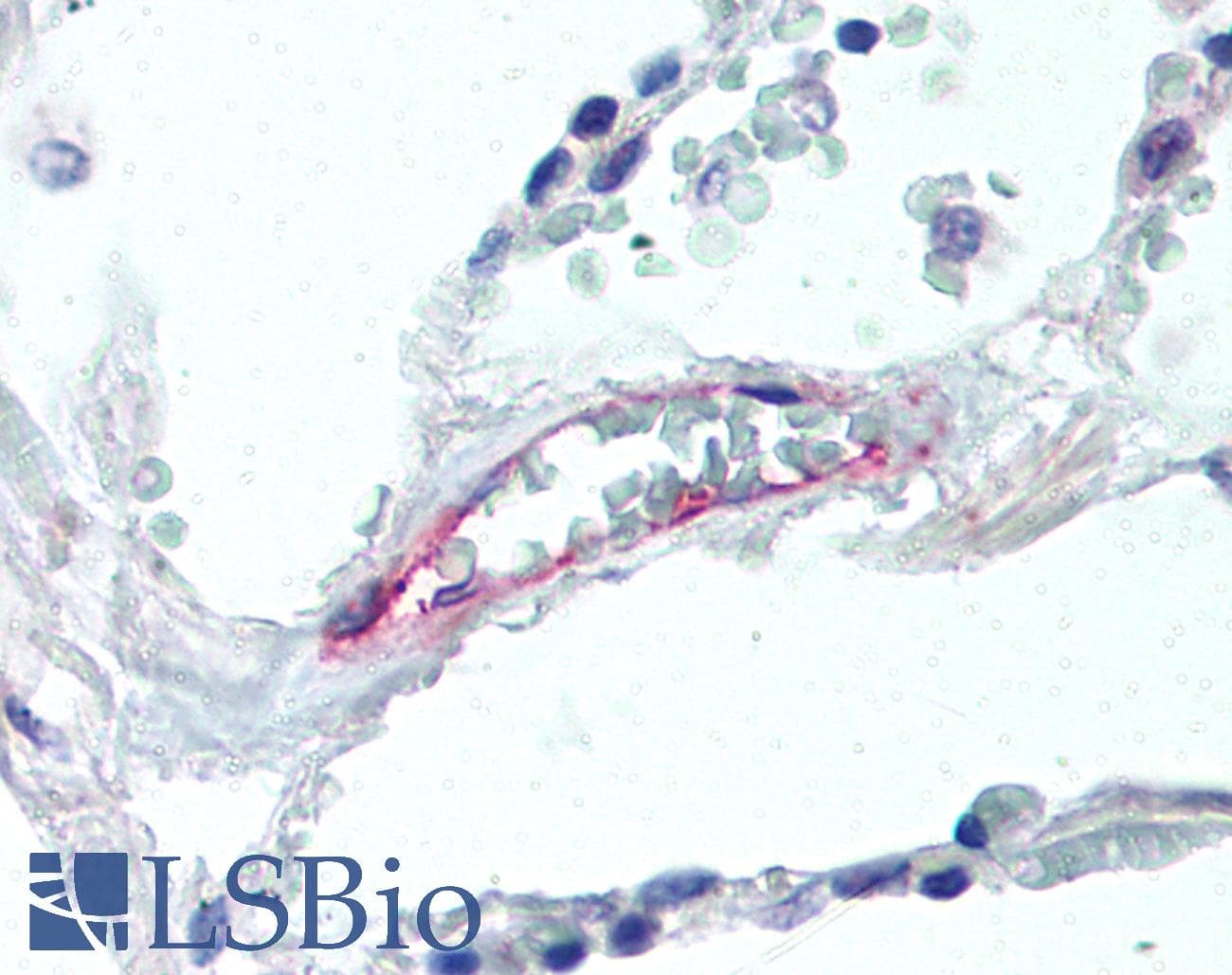 ACKR1 / DARC Antibody (clone 358307, PE)