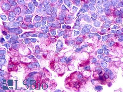 PathPlus™ UTS2R / GPR14 Antibody (N-Terminus)
