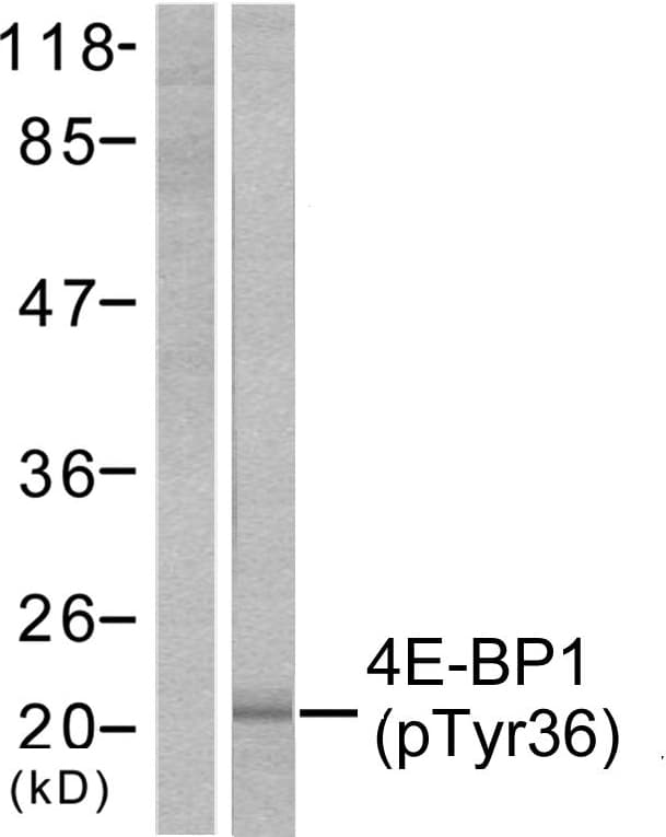 EIF4EBP1 / 4EBP1 Antibody (phospho-Thr36)