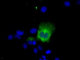 LIPG / Endothelial Lipase Antibody (clone OTI5C3)