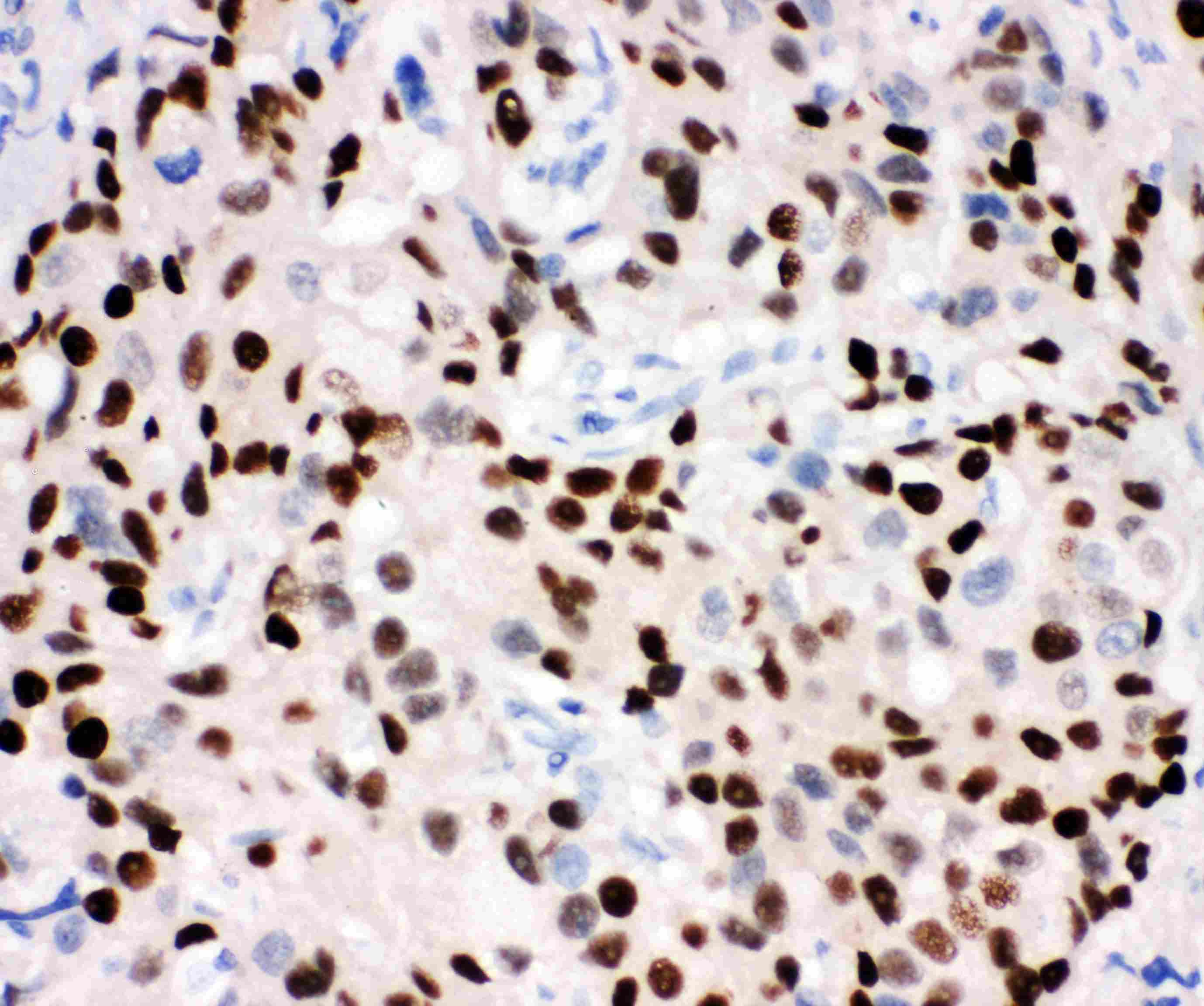 PR / Progesterone Receptor Antibody (aa595-933)