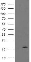 TPD52L3 Antibody (clone OTI6E1)