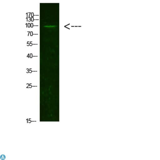 Polyclonal Rabbit anti-Human AR / Androgen Receptor Antibody (WB)