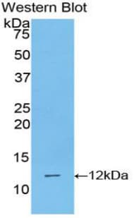 PIGR Antibody (aa250-341)