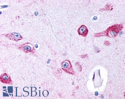 PathPlus™ HTR2B / 5-HT2B Receptor Antibody (N-Terminus)