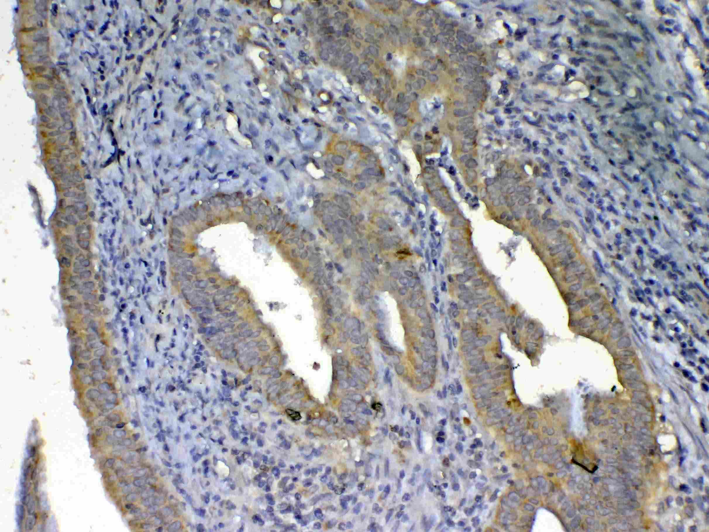 UGT1A / UGT1A1 Antibody