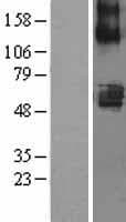 Human SLC22A7 / OAT2 Protein (Over-Expression Lysate Myc-DDK (Flag))