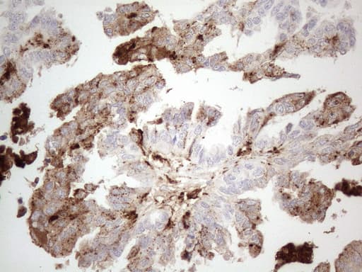 Monoclonal Mouse anti-Human GPNMB / Osteoactivin Antibody (clone OTI2F9, Carrier-free, IHC)