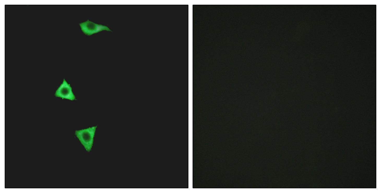 B1R / BDKRB1 Antibody