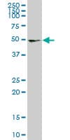 UMPS / OPRT Antibody (clone 2B10)