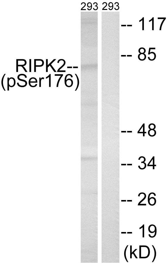 Polyclonal Rabbit anti-Human RICK / RIP2 Antibody (phospho-Ser176, IHC, WB)