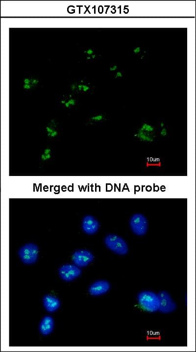 Polyclonal Rabbit anti-Human RASSF2 Antibody (aa1-293, WB)