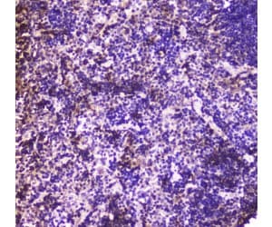 Polyclonal Rabbit anti-Human ANXA6/Annexin A6/Annexin VI Antibody (IHC, WB)