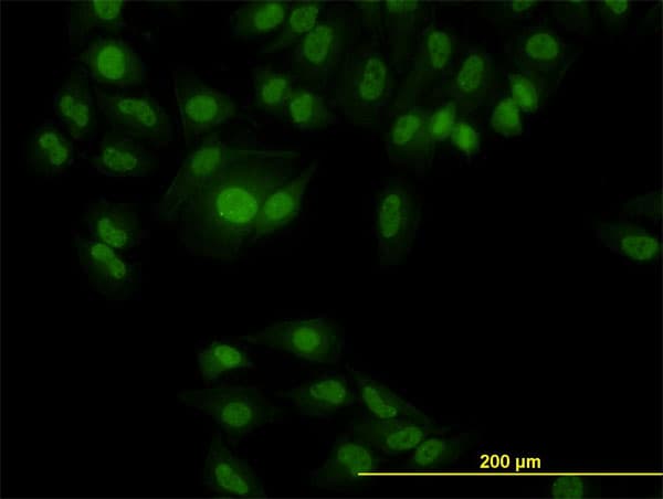IHC-plus™ RBFOX2 / RBM9 Antibody (clone 4G3)
