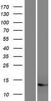 C17orf49 Protein (Over-Expression Lysate Myc-DDK (Flag))
