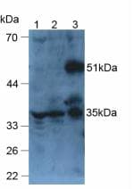 ARP5 / ANGPTL6 Antibody (aa238-457)