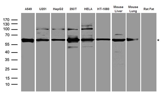 GRK5 Antibody