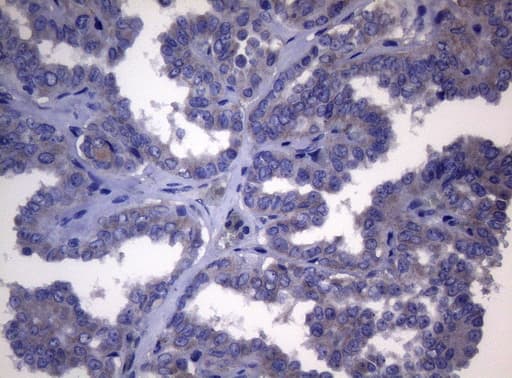 Monoclonal Mouse anti-Human NR1H4 / FXR Antibody (clone OTI4F12, Carrier-free, aa21-297, IHC, WB)