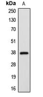 APAF1 / APAF-1 Antibody (C-Terminus)