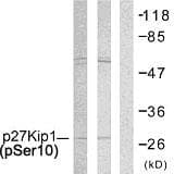 CDKN1B / p27 Kip1 Antibody (phospho-Ser10)