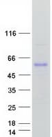 Human CYP51A1 / CYP51 Protein (Recombinant Myc-DDK (Flag))