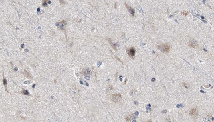 PSEN2 / Presenilin 2 Antibody
