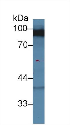 DLG3 / SAP102 Antibody (aa627-802)