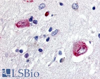 PathPlus™ WNT8A Antibody (Internal)