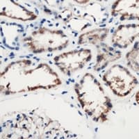 Complement C1s Antibody (C-Terminus)