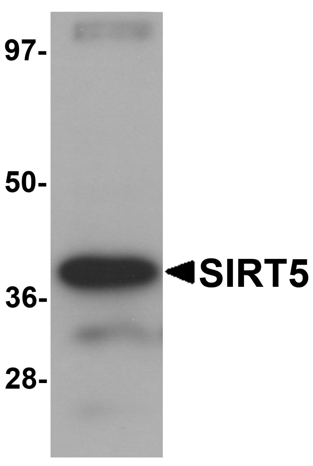 SIRT5 / Sirtuin 5 Antibody